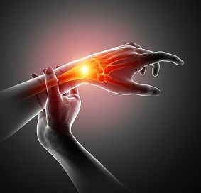 Carpal Instability